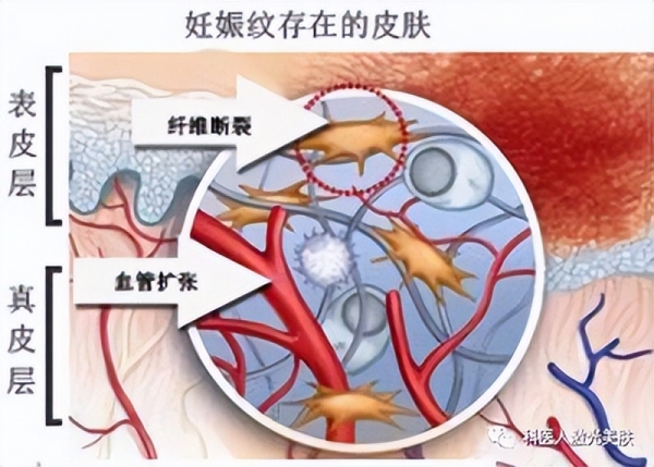 28岁女子凌晨上厕所2天后心衰去世医生摇头：2件事千万别做(图2)